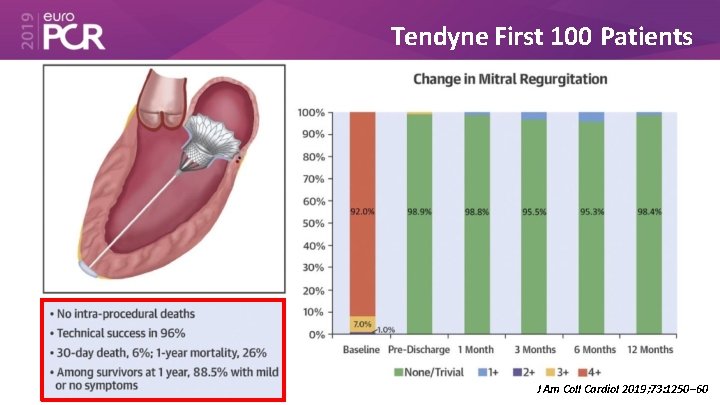 Tendyne First 100 Patients J Am Coll Cardiol 2019; 73: 1250– 60 