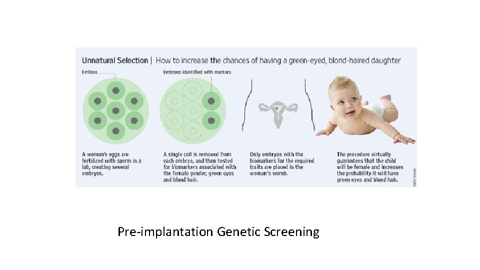 Pre-implantation Genetic Screening 