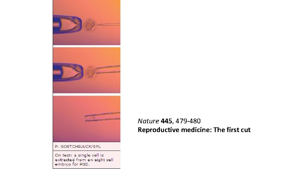 Nature 445, 479 -480 Reproductive medicine: The first cut 