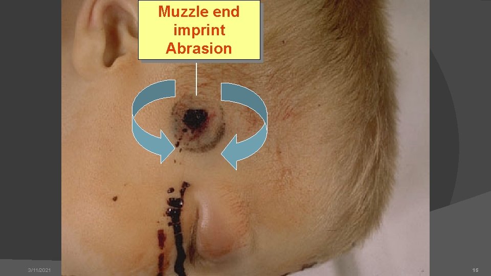 Muzzle end imprint Abrasion 3/11/2021 15 