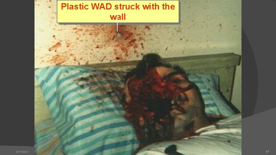 Plastic WAD struck with the wall 3/11/2021 17 