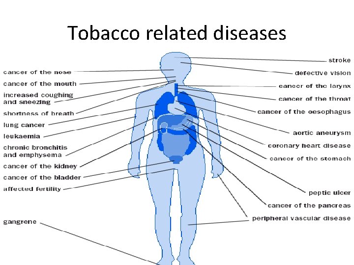 Tobacco related diseases 