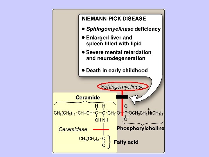 Niemann - Pick Disease 