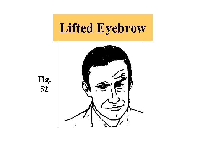 Lifted Eyebrow Fig. 52 