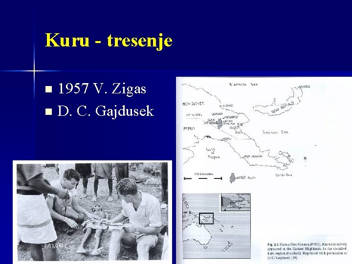 Kuru - tresenje 1957 V. Zigas n D. C. Gajdusek n 3/11/2021 