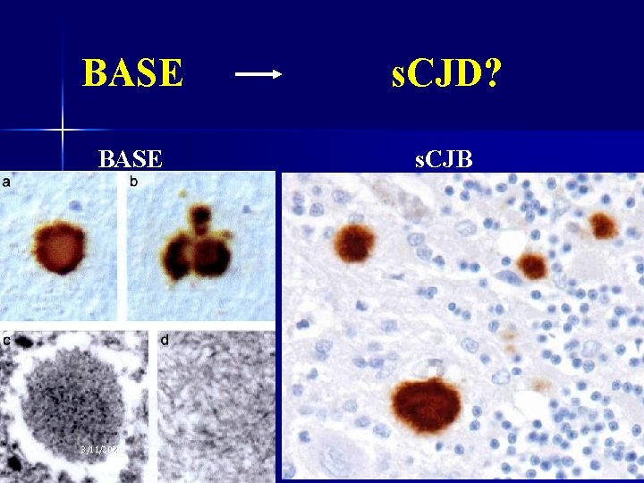 BASE s. CJD? BASE s. CJB 3/11/2021 