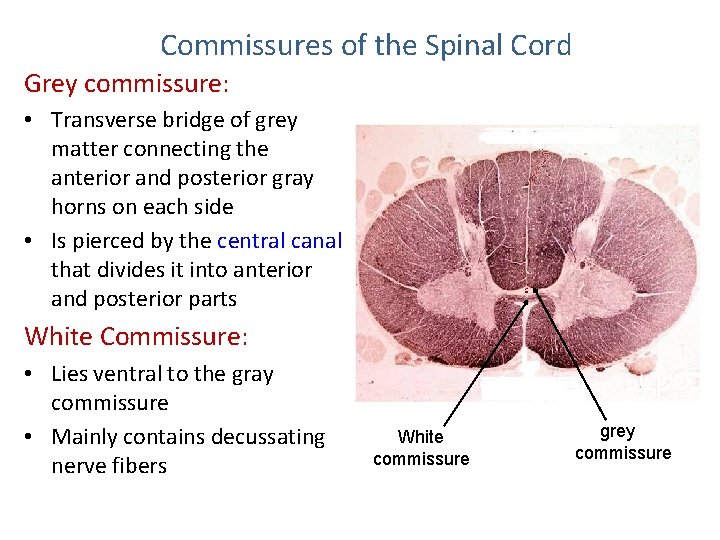 Commissures of the Spinal Cord Grey commissure: • Transverse bridge of grey matter connecting