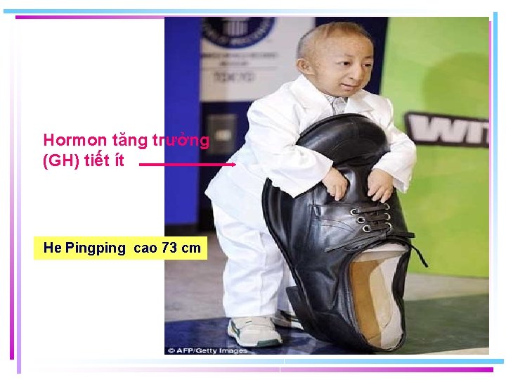 Hormon tăng trưởng (GH) tiết ít He Pingping cao 73 cm 