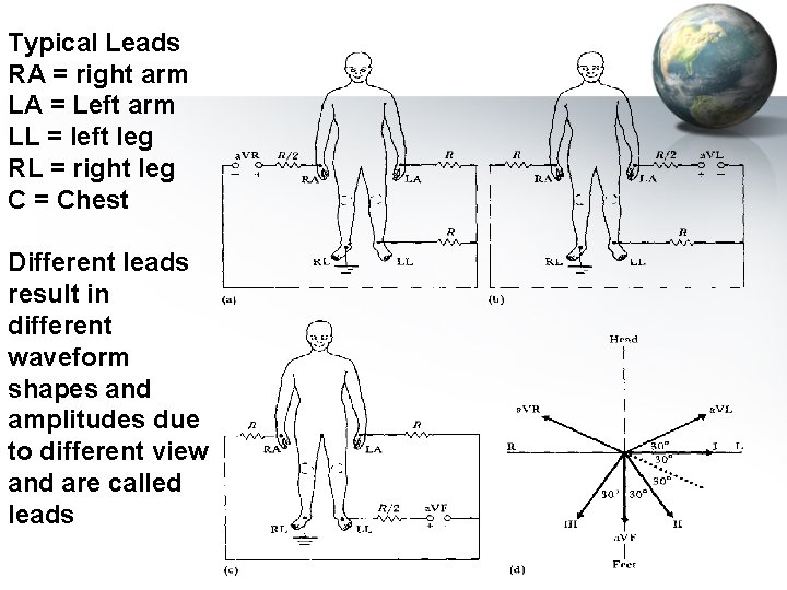 Typical Leads RA = right arm LA = Left arm LL = left leg