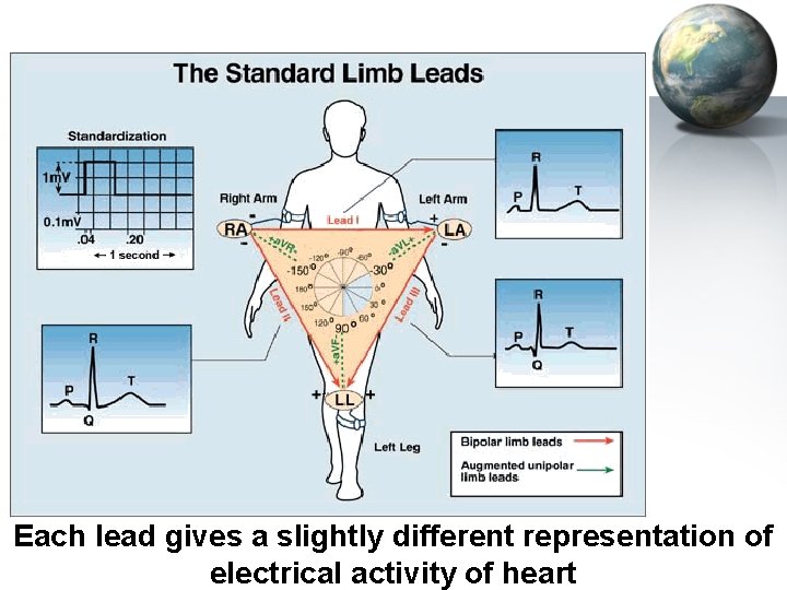 Each lead gives a slightly different representation of electrical activity of heart 