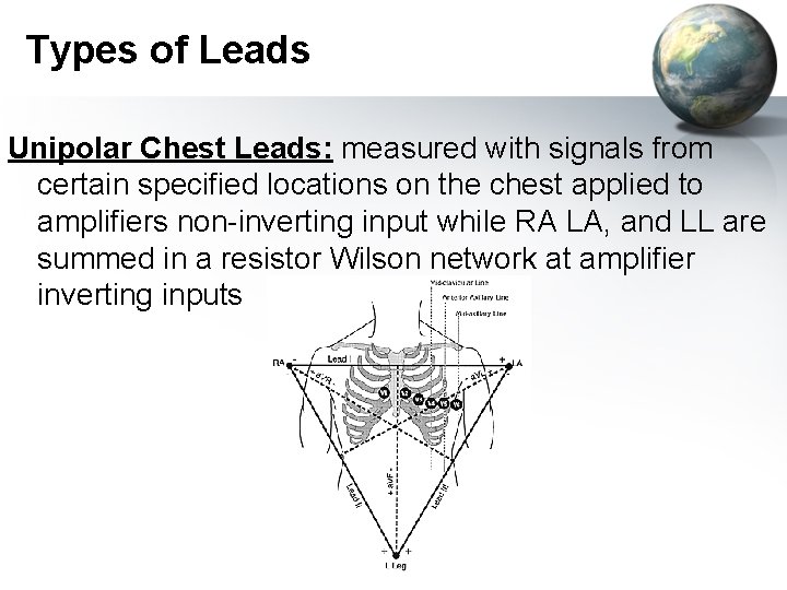 Types of Leads Unipolar Chest Leads: measured with signals from certain specified locations on