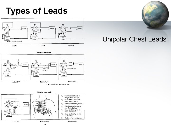 Types of Leads Unipolar Chest Leads 