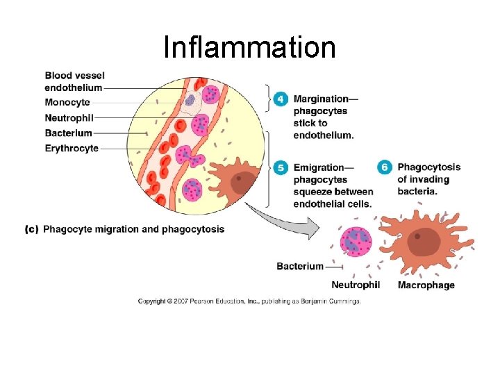 Inflammation 