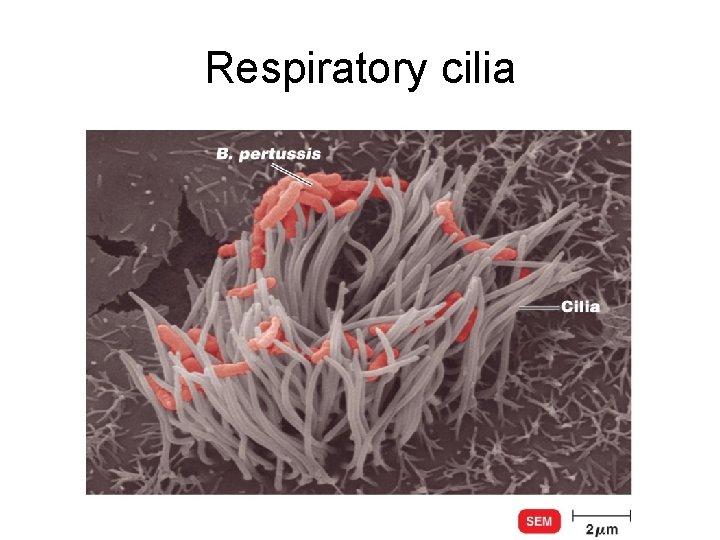 Respiratory cilia 