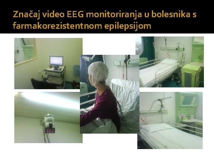 Značaj video EEG monitoriranja u bolesnika s farmakorezistentnom epilepsijom 