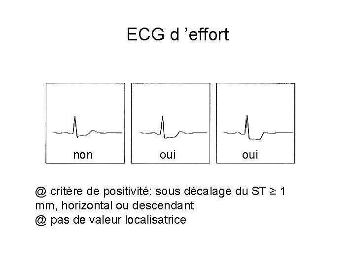 ECG d ’effort non oui @ critère de positivité: sous décalage du ST ≥
