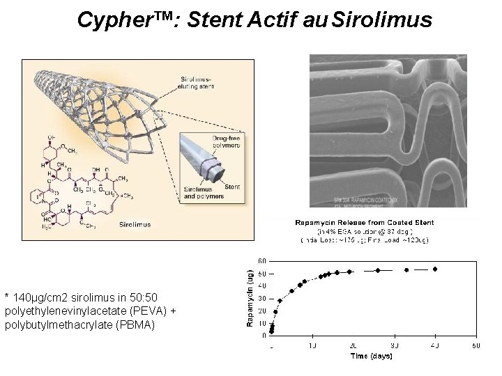 Cypher™: Stent Actif au Sirolimus * 140µg/cm 2 sirolimus in 50: 50 polyethylenevinylacetate (PEVA)