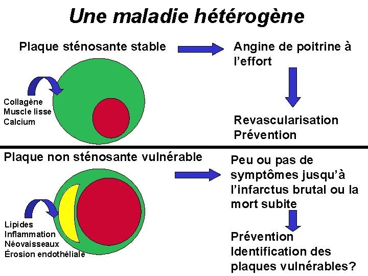 Une maladie hétérogène Plaque sténosante stable Collagène Muscle lisse Calcium Plaque non sténosante vulnérable
