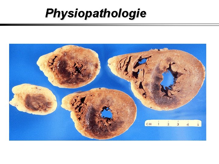 Physiopathologie 