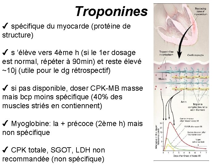 Troponines 4 spécifique du myocarde (protéine de structure) 4 s ’élève vers 4ème h