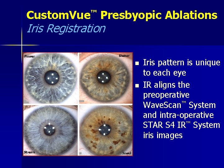 Custom. Vue™ Presbyopic Ablations Iris Registration n n Iris pattern is unique to each