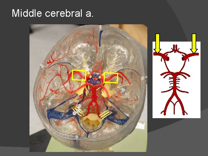 Middle cerebral a. 