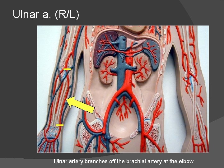 Ulnar a. (R/L) Ulnar artery branches off the brachial artery at the elbow 