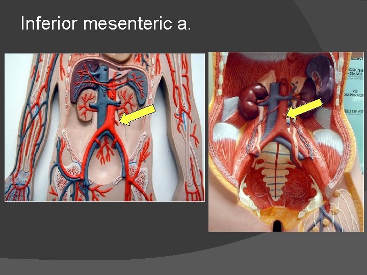 Inferior mesenteric a. 