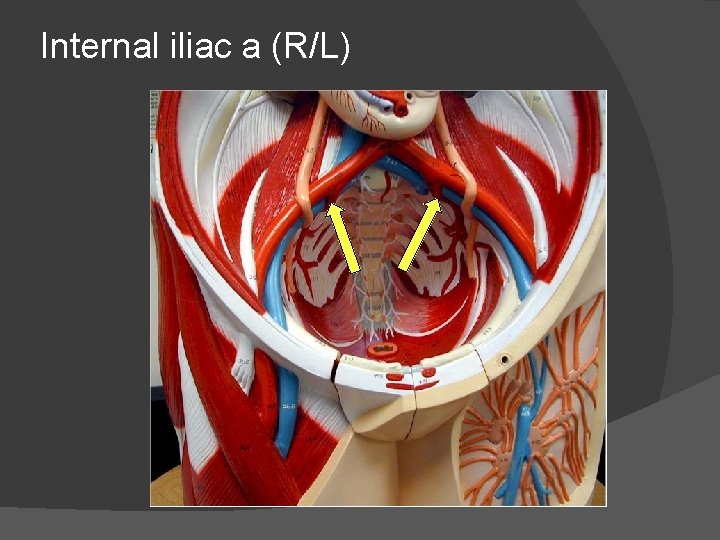 Internal iliac a (R/L) 