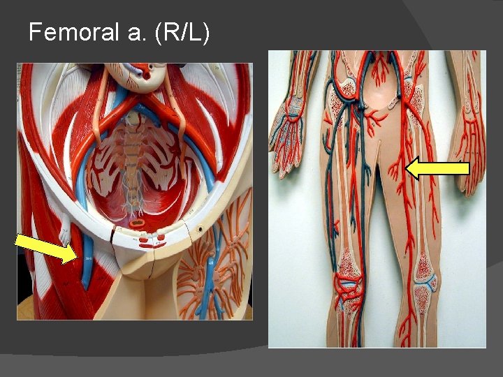 Femoral a. (R/L) 