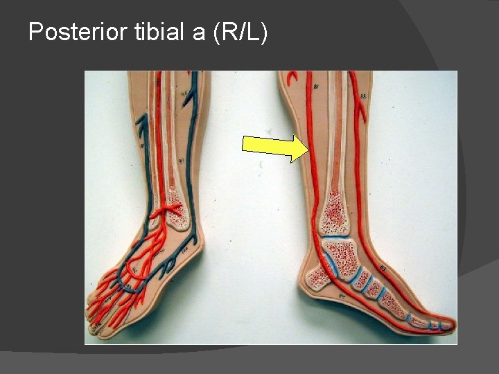 Posterior tibial a (R/L) 