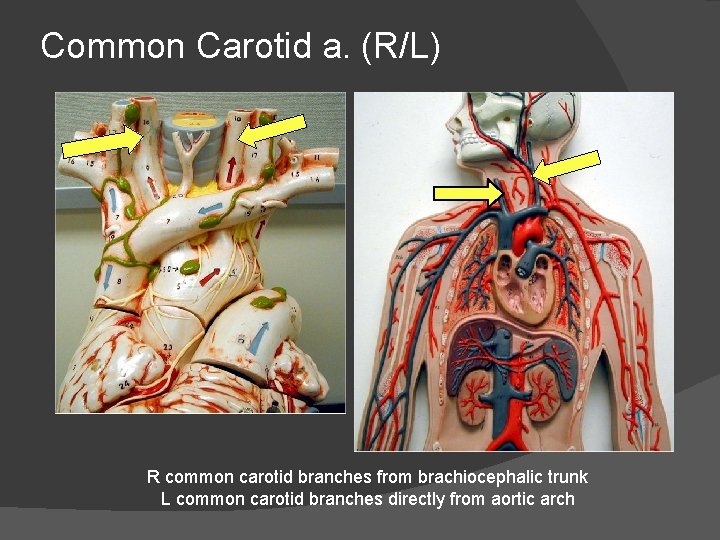 Common Carotid a. (R/L) R common carotid branches from brachiocephalic trunk L common carotid