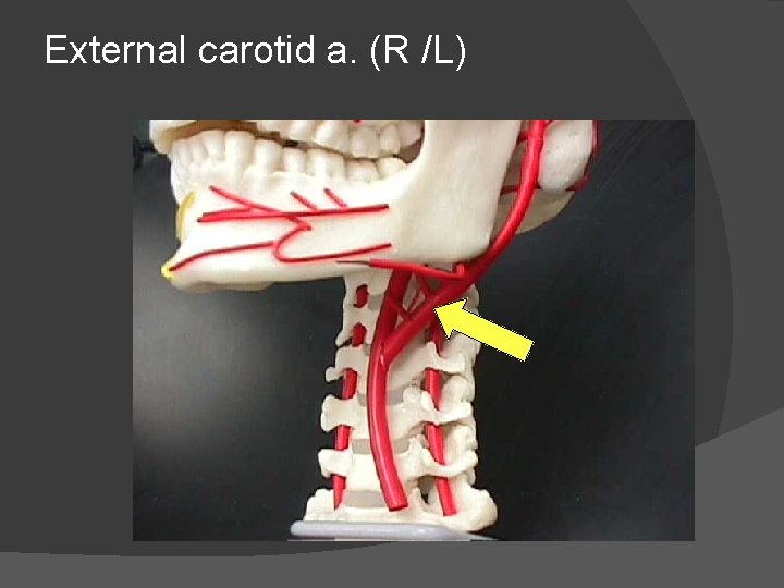 External carotid a. (R /L) 