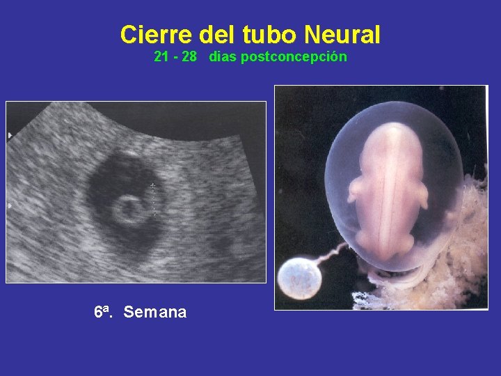 Cierre del tubo Neural 21 - 28 dias postconcepción 6ª. semana 6ª. Semana 