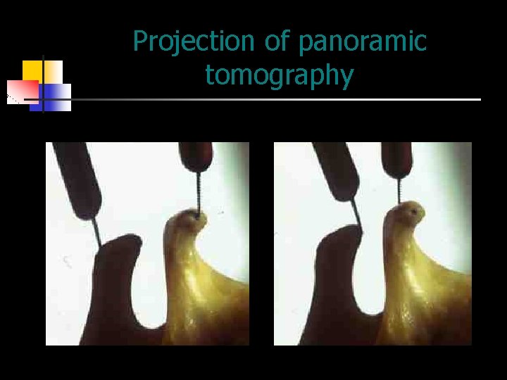 Projection of panoramic tomography 