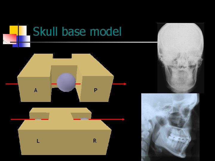Skull base model A L P R 