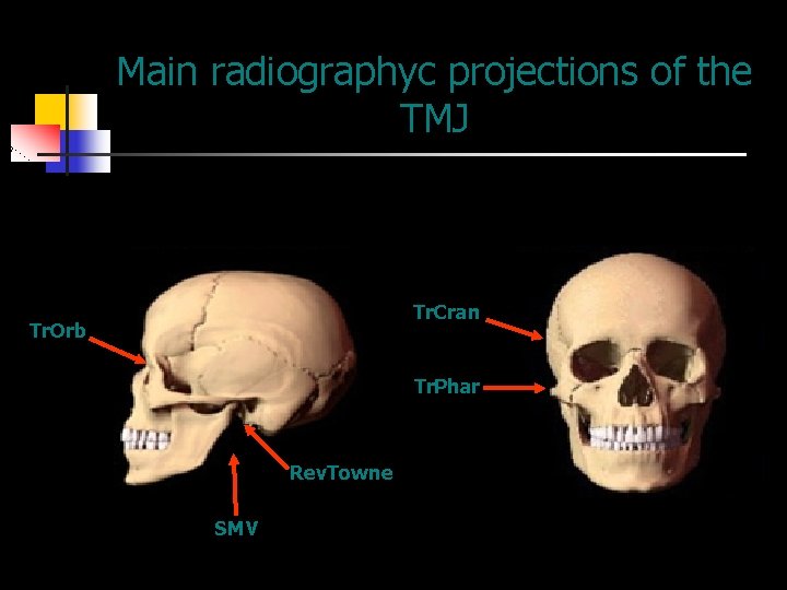 Main radiographyc projections of the TMJ Tr. Cran Tr. Orb Tr. Phar Rev. Towne
