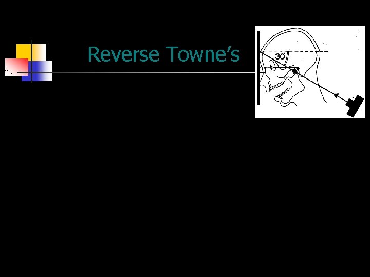 Reverse Towne’s 