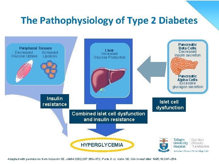 The Pathophysiology of Type 2 Diabetes Peripheral Tissues Decreased Increased Glucose Uptake Lipolysis Liver