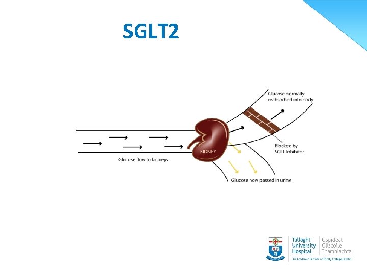 SGLT 2 29 