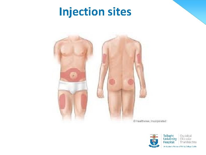 Injection sites 