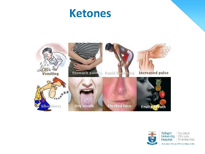 Ketones 