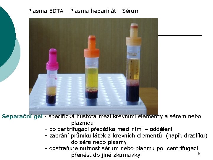 Plasma EDTA Plasma heparinát Sérum Separační gel - specifická hustota mezi krevními elementy a