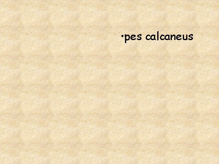  • pes calcaneus 