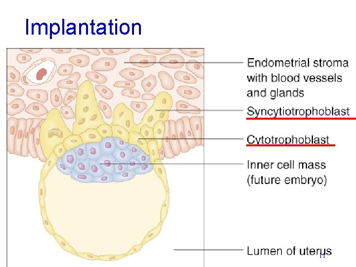 Implantation 11 