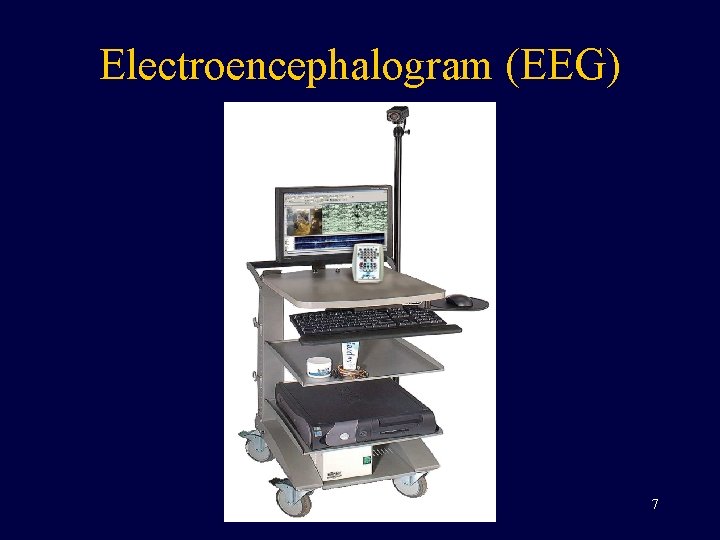 Electroencephalogram (EEG) 7 