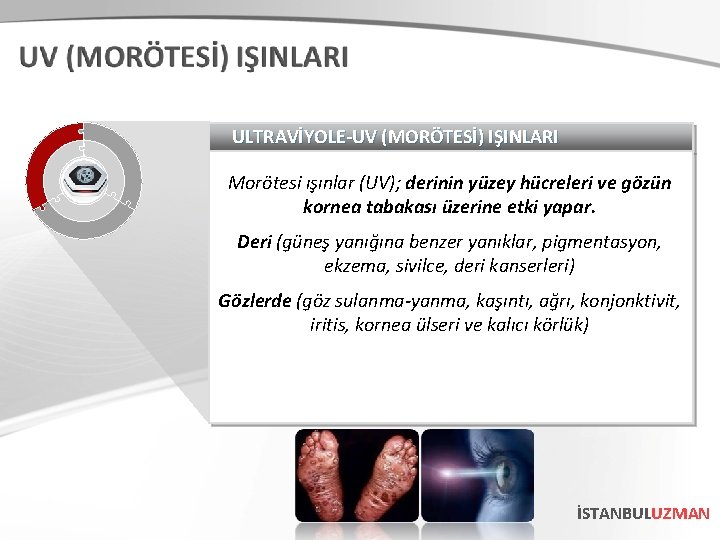 ULTRAVİYOLE-UV (MORÖTESİ) IŞINLARI Morötesi ışınlar (UV); derinin yüzey hücreleri ve gözün kornea tabakası üzerine