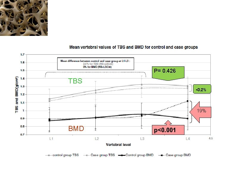 P= 0. 426 TBS -3. 2% 19% BMD p<0. 001 