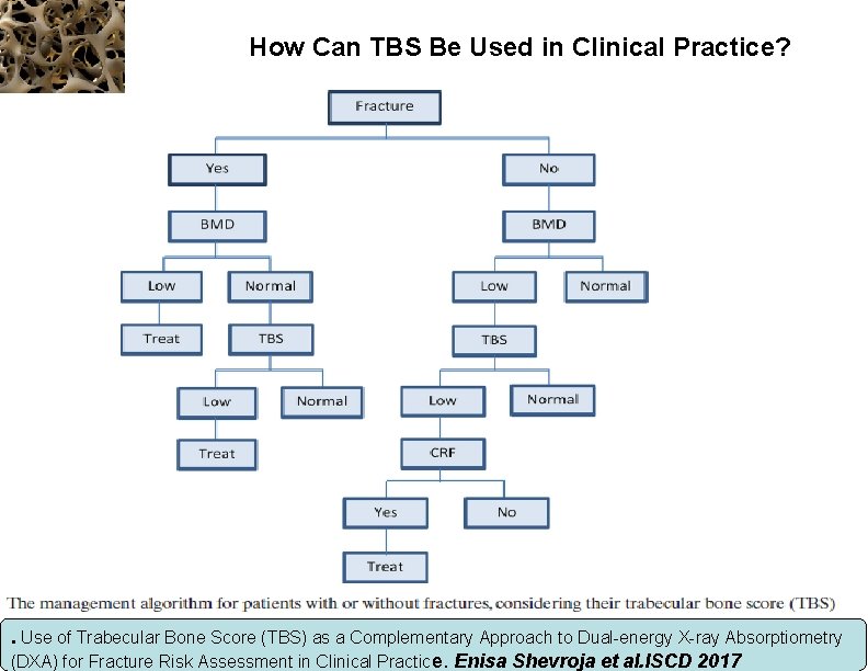 How Can TBS Be Used in Clinical Practice? . Use of Trabecular Bone Score