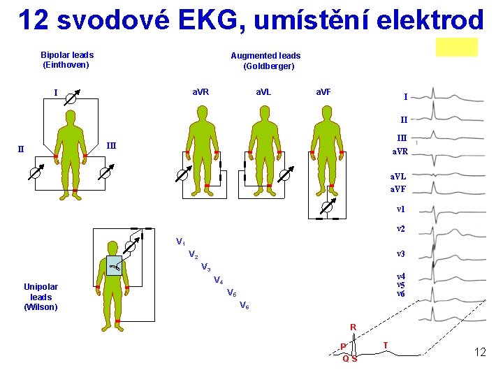 12 svodové EKG, umístění elektrod Bipolar leads (Einthoven) Augmented leads (Goldberger) a. VR I